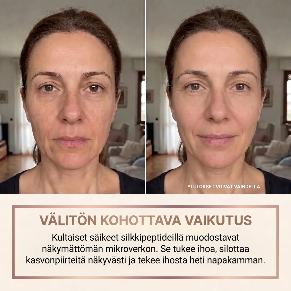 Tulos ennen ja jälkeen Zelia-kohotusseerumin käytön