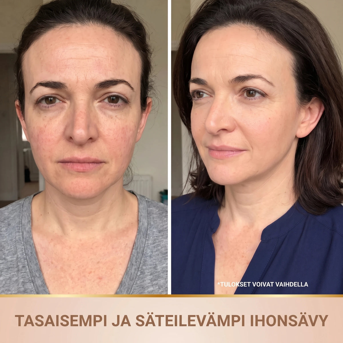 Ennen ja jälkeen: tasaisempi ja säteilevämpi ihonsävy
